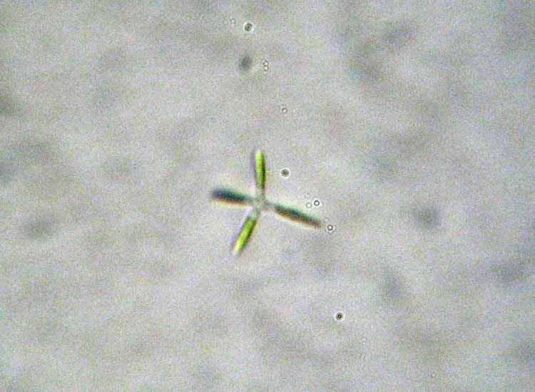 Canale Bruciati, SIC Valli di Novellara RE: le alghe